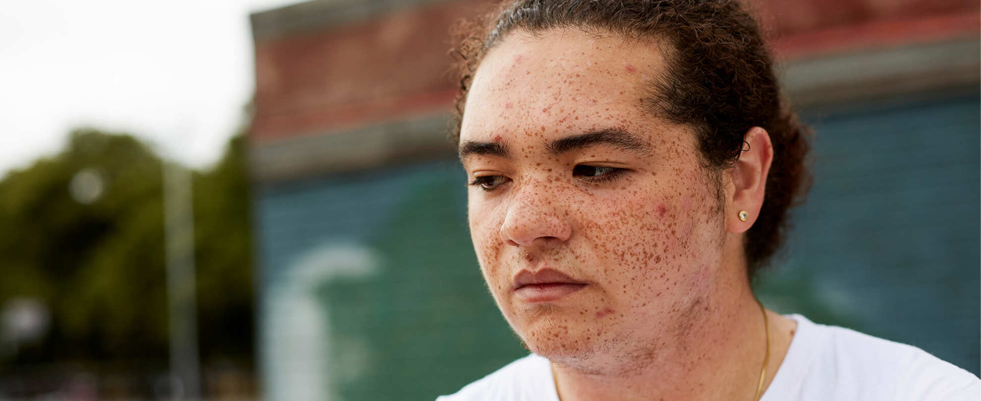 Close up of a boy sitting in a park. His expression seems worried as if deep in thought.